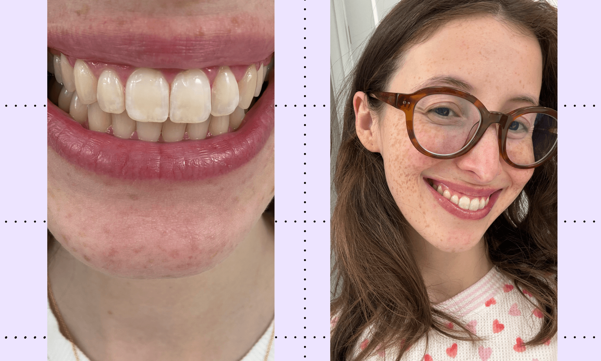 before/after