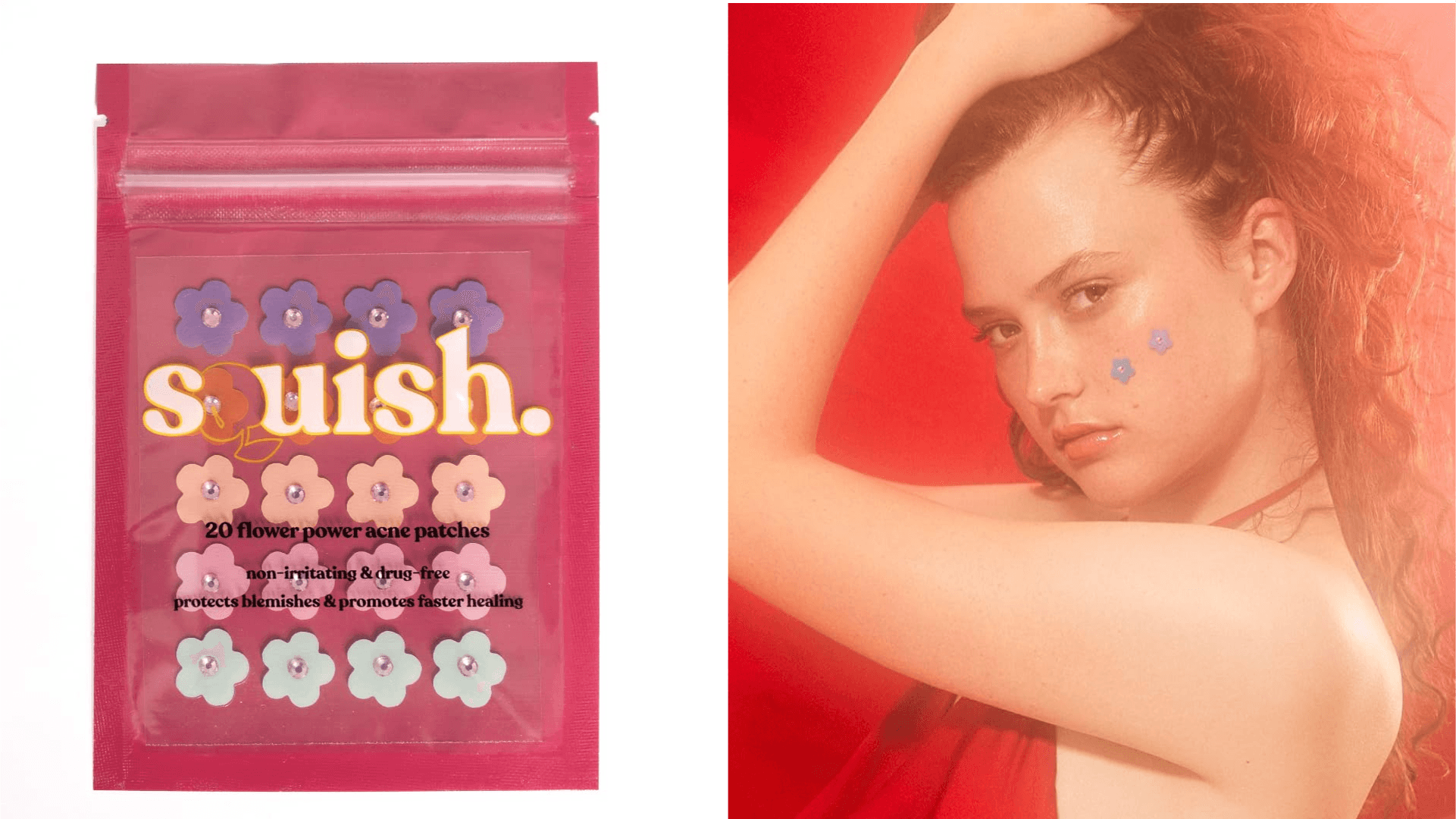 Acne patches