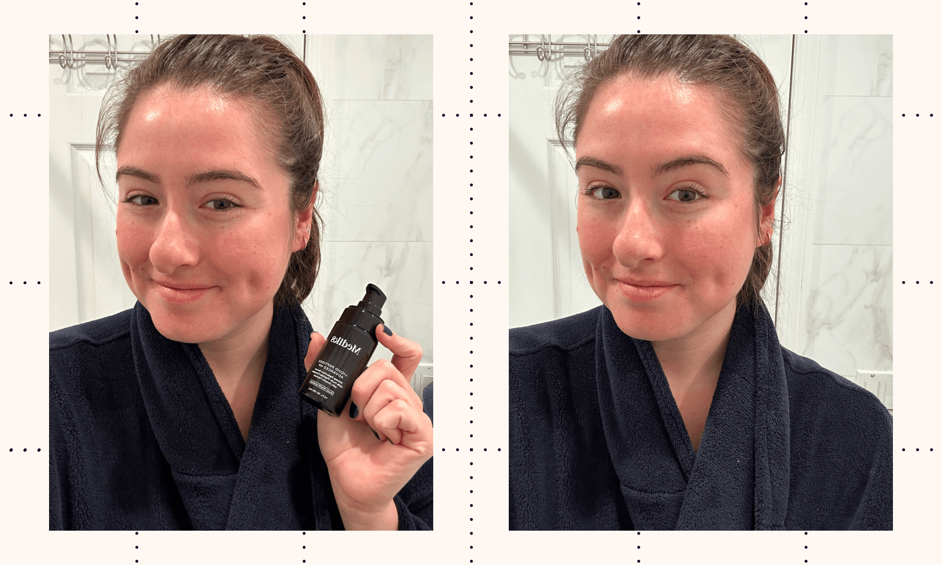 Alessandra Before/After