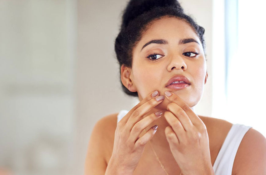 Featured image for Ever Get Hairy Zits? A Derm Explains What This Means