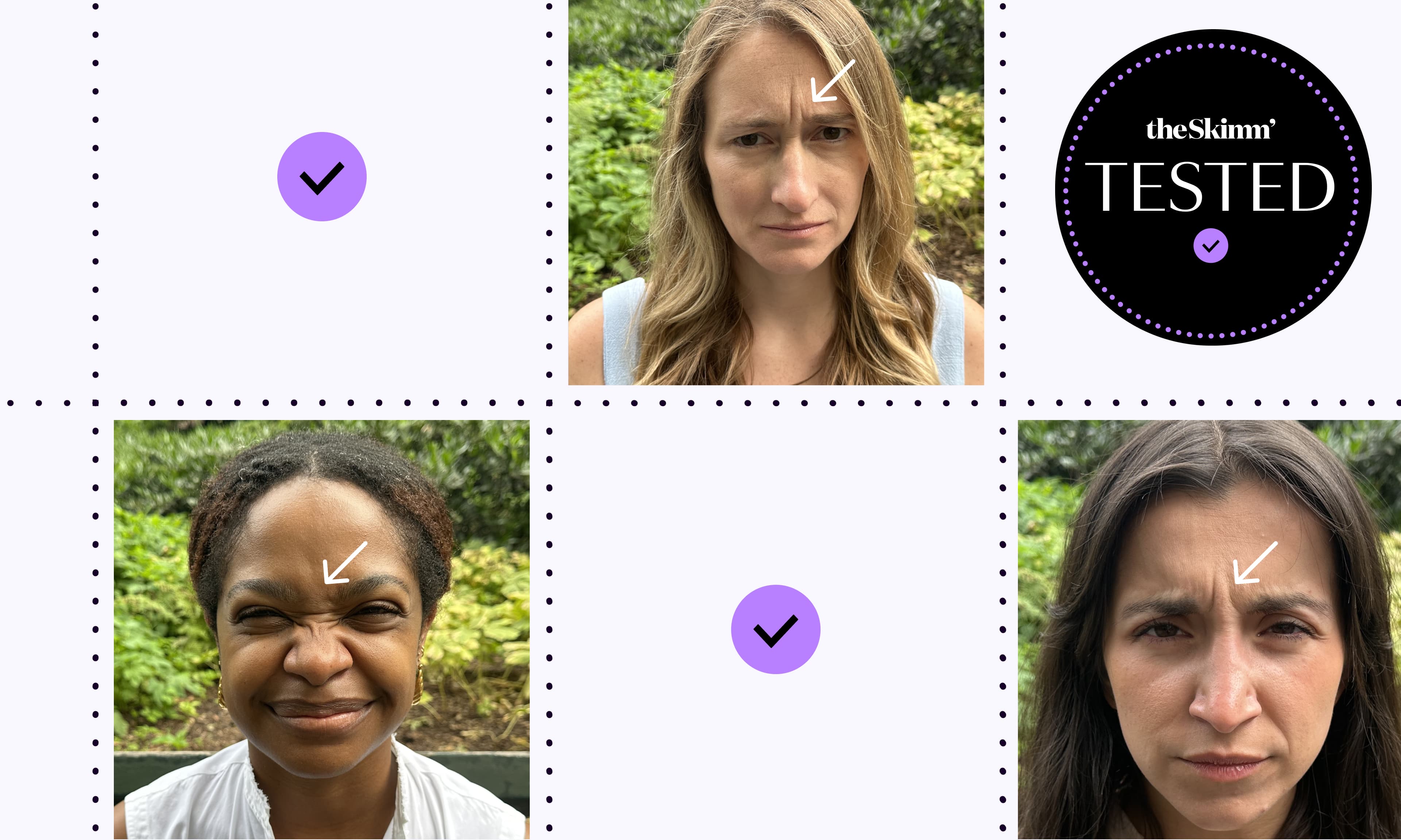 images of testers before dysport