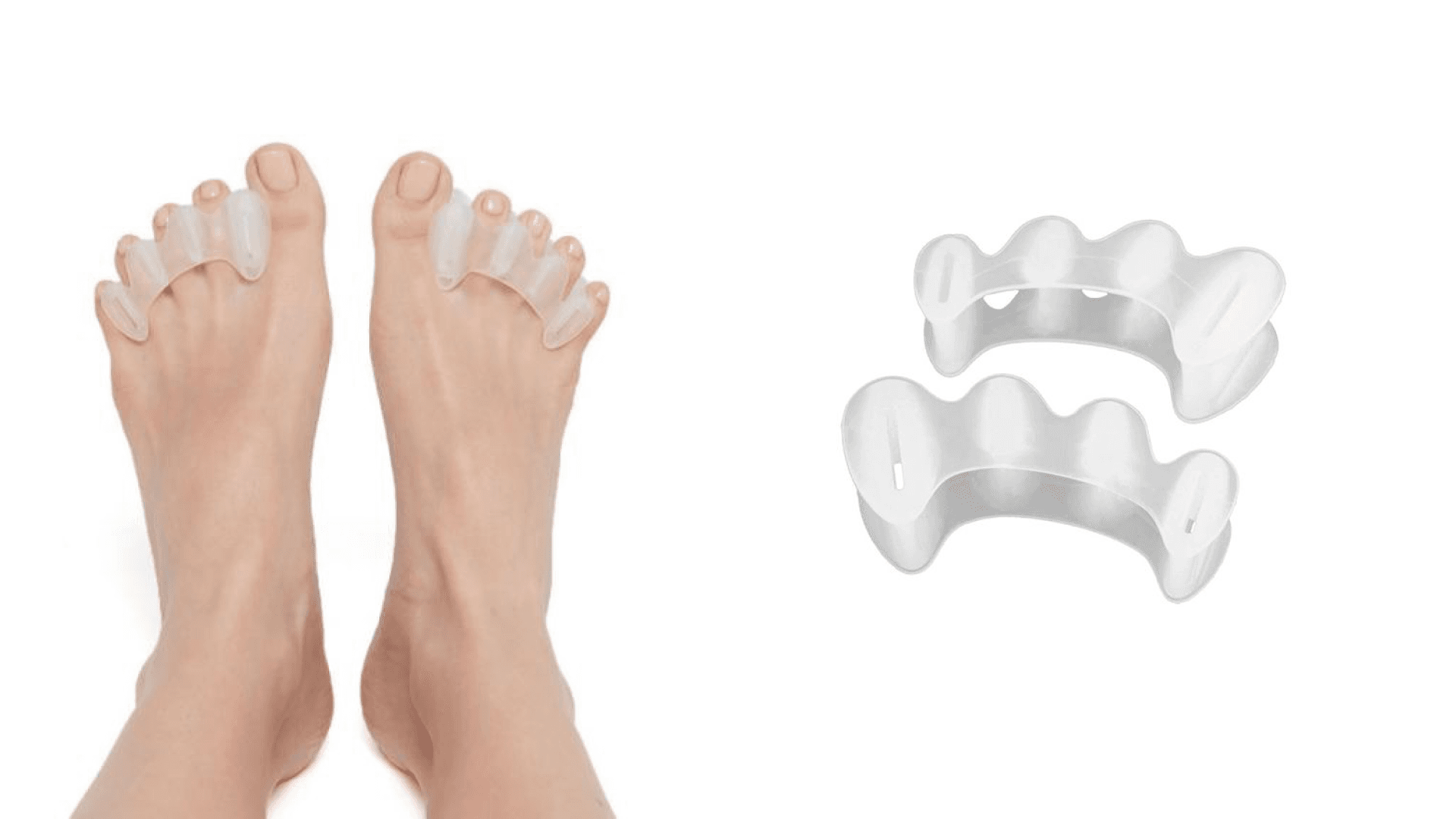 SoftStar Shoes, Correct Toes