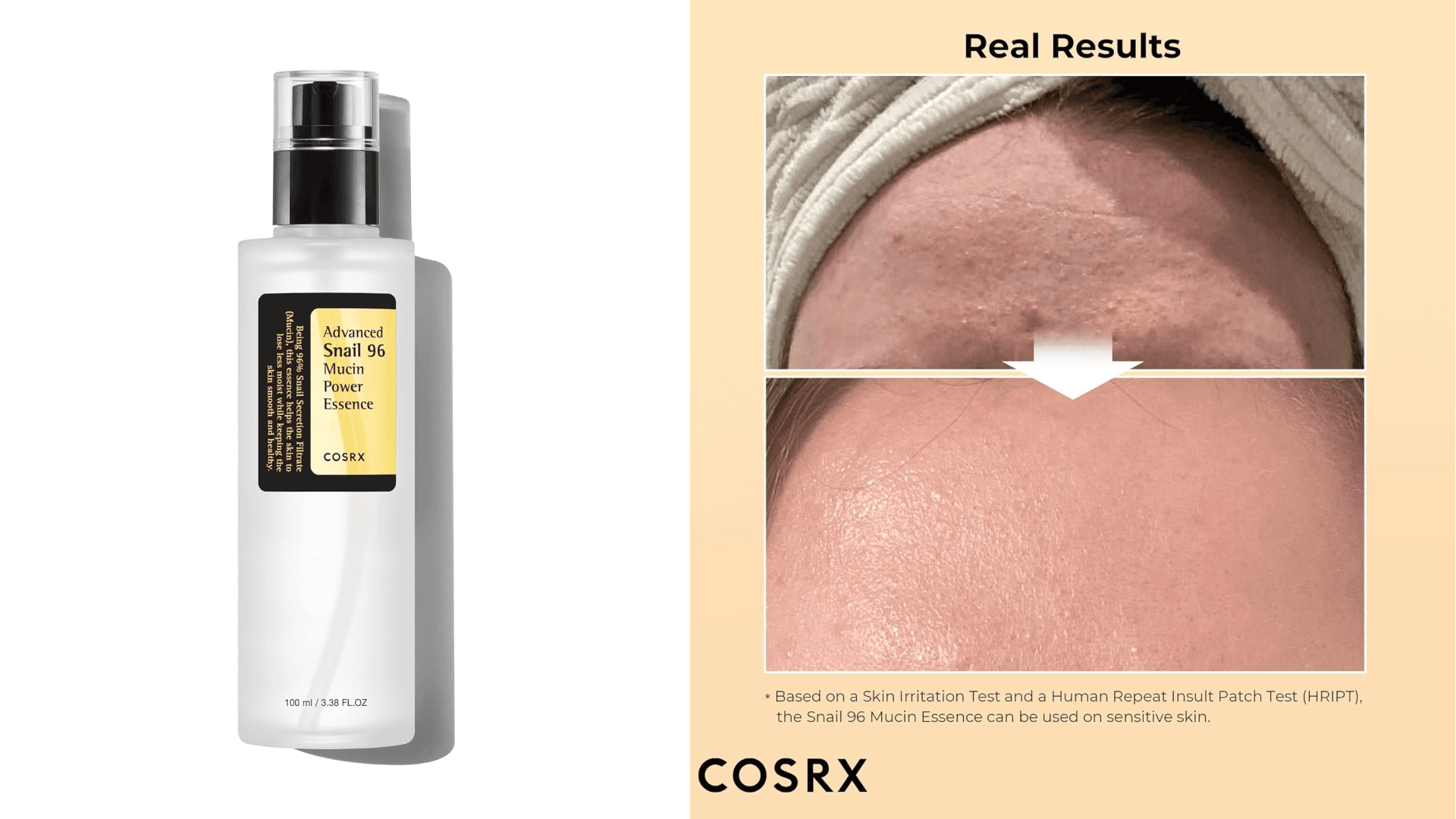 snail mucin